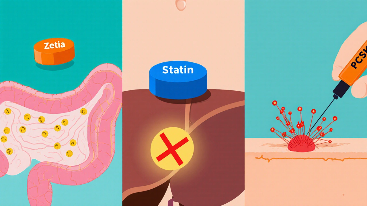 Cartoon showing Zetia blocking gut cholesterol, statins reducing liver production, and PCSK9 inhibitors increasing LDL clearance.